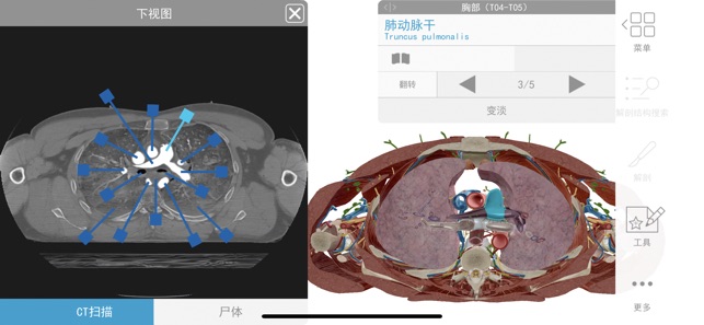 人体解剖学图谱app下载 2023人体解剖学图谱 for iPhone V2023.4.11 苹果手机版-1
